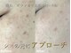 ココスターリー(Coco starry)の写真