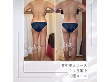 レムロード 赤羽店/背中、腰、ヒップ太ももスッキリ