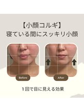 ソレスト 田町 三田店(SOLEST)/小顔コルギ