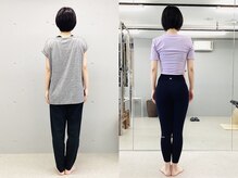 イレ 名古屋栄(ile)/5回でO脚と肩の左右差をリセット