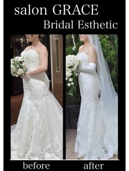 サロン グレイス(salon GRACE)/