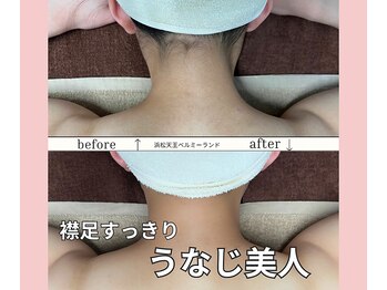 浜松富塚ベルミーランド/脱毛Before→After