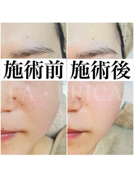 ラピリカ(LA PRICA)/