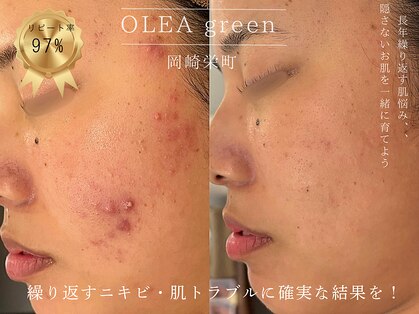 オレアグリーン 岡崎(OLEA green)の写真