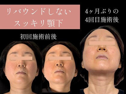 クアダ 天神(QUADA)の写真