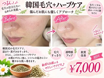 ウィズマツオカ 光の森店の写真/黒ずみ毛穴にもアプローチ！高濃度美容液で毛穴レスなつるんと滑らか肌へ◎ハリツヤ根本肌質改善の施術！
