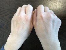 ビューティフィール アンド アリサナ(Beauty Feel&Arisana)/リベルハーブピーリングの比較♪