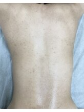 ナノハナ/鹿沼市の全身脱毛美容室ナノハナ