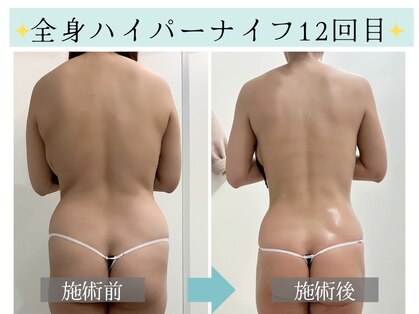 スリムプロ 天王寺店(Slimpro)の写真