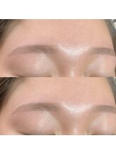 ソレ シャーム(sole charme)/平行アーチ