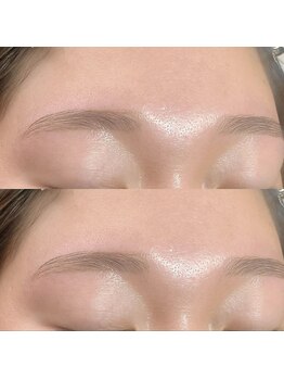 ソレ シャーム(sole charme)/平行アーチ