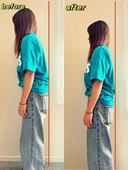 アンティオール 中目黒店/そり腰も改善します☆