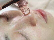 ラウレア/ハーブピーリング×毛穴洗浄