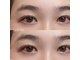 トレス(tress)の写真