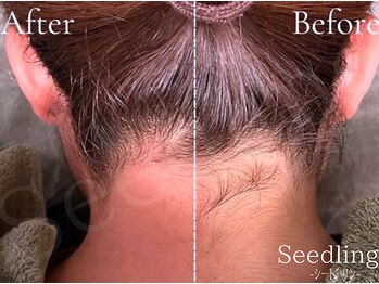 シードリン(Seedling)/うなじワックス