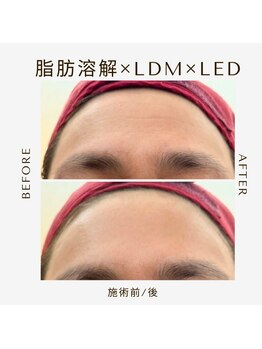 ツヤハダコガオ 千葉店/before⇒after【レモンボトル】