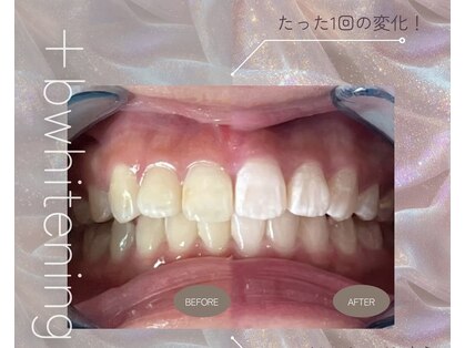 プラスビー 3号店(+b)の写真