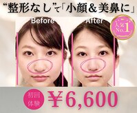 隆鼻矯正専門店 ラプリ(Raplit)