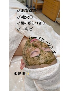 ルポアン(Repos an)/ハーブピーリング