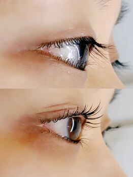 サロンドルル(Salon de Lulu)/マツパ上下　逆まつげ改善