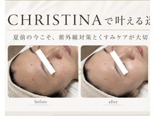 ルチル 八女店(Rutile)の雰囲気（八女初メニュー多数！人気No.1CHRISTINA×OPTILで肌質改善）