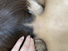 ナノハナ/鹿沼市の全身脱毛美容室ナノハナ