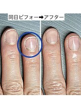 桃の木 吉祥寺店/甘皮ケアでスッキリ