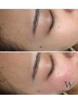 ホワイトワックス 京都四条烏丸(WHITE WAX)/《全顔》フェイシャルワックス