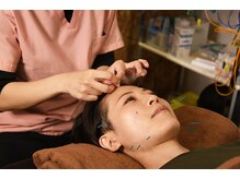 ヘルスラボ 狛江の雰囲気（はり施術や美容鍼などの鍼灸メニューも人気★リピーター続出♪）