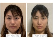 トイボーテ(toi beaute)の雰囲気（一回で激変も！！小顔整顔メソッドで本来の美しさを取り戻そう）