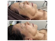 ココ平塚店(COCO)の雰囲気（オンダリフトbefore→after）