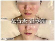 ラ ドゥーサ(La Dusa)/左右差/歪み改善にも韓国コルギ