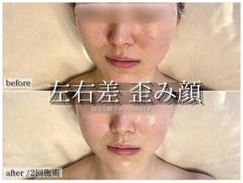 ラ ドゥーサ(La Dusa)/左右差/歪み改善にも韓国コルギ