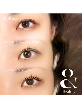 クレー(Klee)/アンドヘルシー