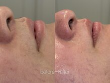 リコ ヘアアンドリラクゼーション(LICO)/フェイスワックス