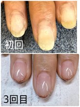 ローネイル(Raw nail)/