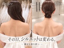 ピクサー(PIXAR)の雰囲気（6回の施術で肩甲骨ラインに変化♪ドレスが美しく映える後ろ姿へ）