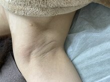 ナノハナ/鹿沼市の全身脱毛美容室ナノハナ