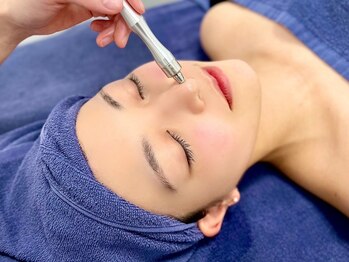 オーシャンブルー 佐世保店(OCEAN BLUE)/ダイヤモンドピーリング