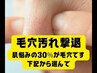 【再来】毛穴の黒ずみ改善 ハイドロフェイシャル/全顔＆デコルテ16200→12800