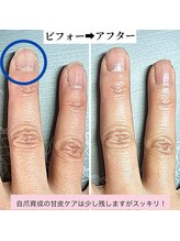 桃の木 吉祥寺店/甘皮ケアでスッキリ2