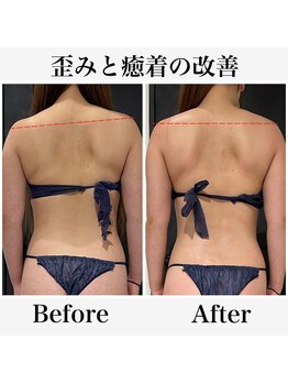 クリア(CLEAR)/リヴァイセルボディ