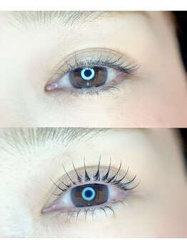 サロン エフ(salonF)/ビフォーアフター