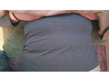 エクラーレ(eclare)/美姿勢調整