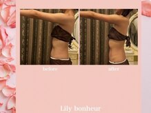 リリー ボヌール(Lily bonheur)/美腕ボディトリートメント
