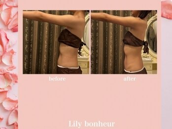 リリー ボヌール(Lily bonheur)/美腕ボディトリートメント