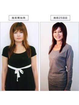 カパリリ/ビフォーアフター写真