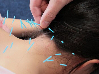 旭堂/デスクワークの方の鍼灸メニュー