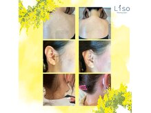 リソ ワキシング サロン(Liso waxing salon)の雰囲気（人気のうなじ背中もみあげワックス脱毛♪ ）