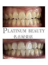 プラチナムビューティー 名古屋栄本店(PLATINUM BEAUTY)/お客様Before After